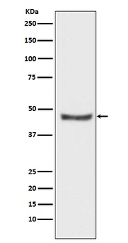 PHD2/prolyl hydroxylase Rabbit Monoclonal Antibody
