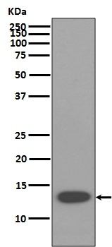 beta 2 Microglobulin B2M Rabbit Monoclonal Antibody