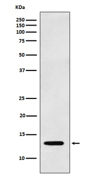 Galectin 1 LGALS1 Rabbit Monoclonal Antibody