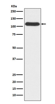 OGT Rabbit Monoclonal Antibody