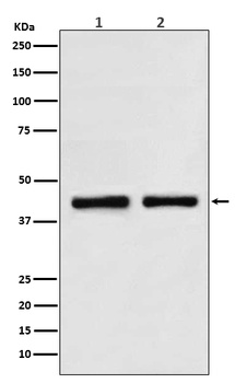 SNF5 SMARCB1 Rabbit Monoclonal Antibody