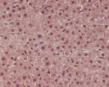 STAT6 Rabbit Monoclonal Antibody