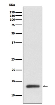 ROC1 Rabbit Monoclonal Antibody