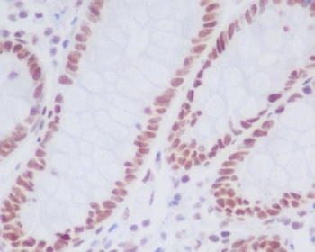 KDM1/LSD1 KDM1A Rabbit Monoclonal Antibody
