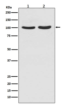 Androgen Receptor AR Rabbit Monoclonal Antibody