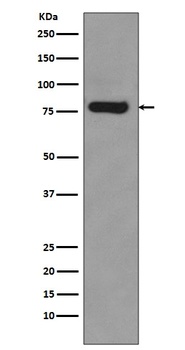 Androgen Receptor Rabbit Monoclonal Antibody