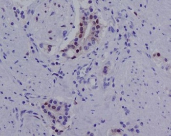 Androgen Receptor Rabbit Monoclonal Antibody