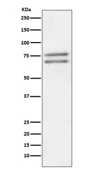 ADAM10 Rabbit Monoclonal Antibody