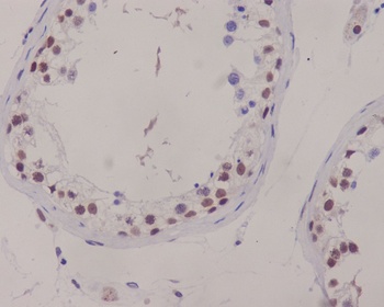 XRCC1 Rabbit Monoclonal Antibody