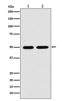 LOX Rabbit Monoclonal Antibody