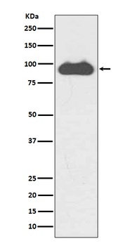Transferrin Receptor TFRC Rabbit Monoclonal Antibody