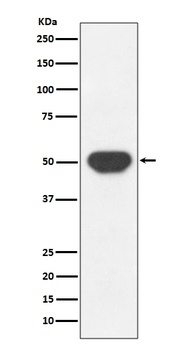 PTP1B PTPN1 Rabbit Monoclonal Antibody