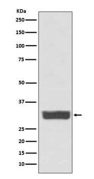 Galectin 3 LGALS3 Rabbit Monoclonal Antibody