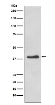 DKK1 Rabbit Monoclonal Antibody