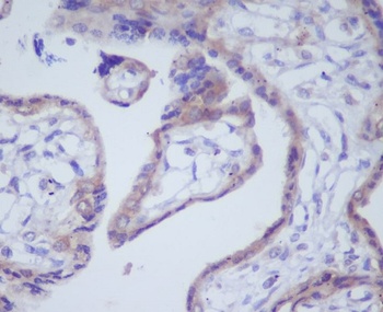 DKK1 Rabbit Monoclonal Antibody