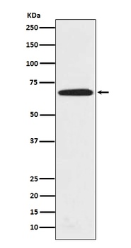 PRMT5 Rabbit Monoclonal Antibody