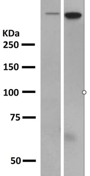 DNA-PKcs PRKDC/DNA Rabbit Monoclonal Antibody