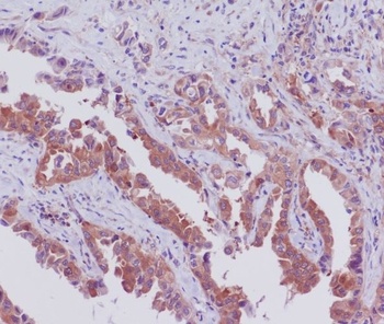 SGK1/Sgk Rabbit Monoclonal Antibody