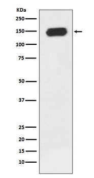 PLCG1/Plc Gamma 1 Rabbit Monoclonal Antibody