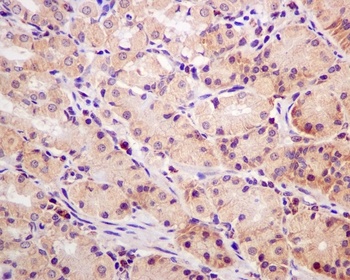 MCL1 Rabbit Monoclonal Antibody