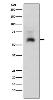 Smad1 Rabbit Monoclonal Antibody