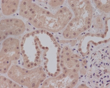 Smad1 Rabbit Monoclonal Antibody