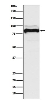 TGF beta Receptor II TGFBR2 Rabbit Monoclonal Antibody