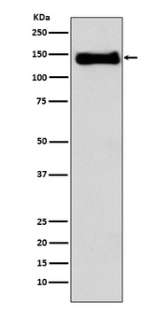 Integrin beta 1 ITGB1 Rabbit Monoclonal Antibody