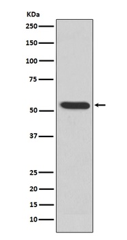 MMP3 Rabbit Monoclonal Antibody