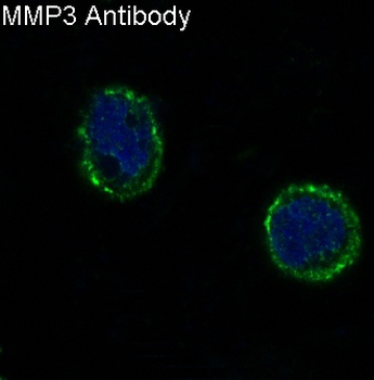 MMP3 Rabbit Monoclonal Antibody
