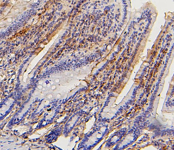Collagen III/COL3A1 Antibody (monoclonal, 9H9)