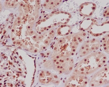 ERG Rabbit Monoclonal Antibody