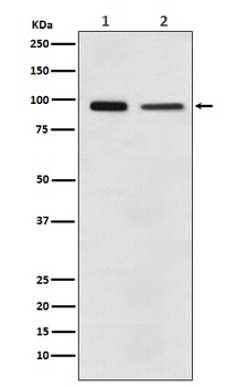 EEF2 Rabbit Monoclonal Antibody