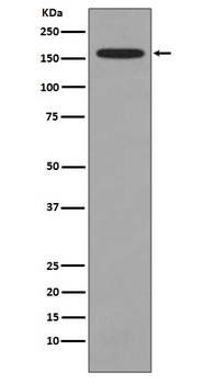 KMT4/Dot1L Rabbit Monoclonal Antibody