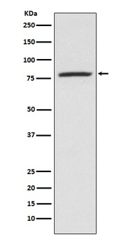 5 Lipoxygenase ALOX5 Rabbit Monoclonal Antibody