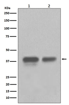CDX2 Rabbit Monoclonal Antibody