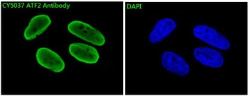 ATF2 Rabbit Monoclonal Antibody
