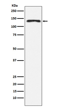 NEDD4 Rabbit Monoclonal Antibody