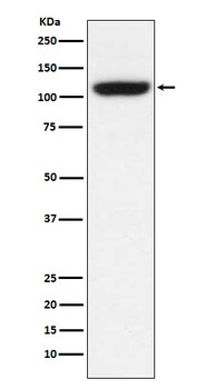 TRPM8 Rabbit Monoclonal Antibody