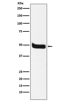 Neurokinin 1 Receptor Rabbit Monoclonal Antibody