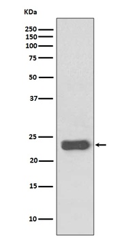 MGMT Rabbit Monoclonal Antibody