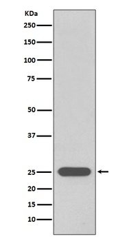 PGP9.5 UCHL1/PGP9 Rabbit Monoclonal Antibody