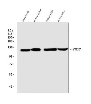 PMS2 Rabbit Monoclonal Antibody