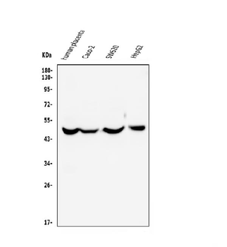 EDNRB Mouse Monoclonal Antibody