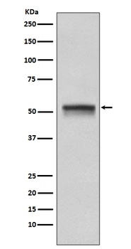 Chk1 CHEK1 Rabbit Monoclonal Antibody