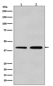 alpha smooth muscle Actin ACTA2 Rabbit Monoclonal Antibody