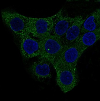 alpha smooth muscle Actin ACTA2 Rabbit Monoclonal Antibody