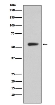 CA9/Ca Ix Rabbit Monoclonal Antibody