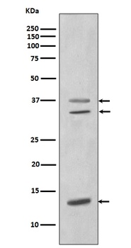 CEBP beta Rabbit Monoclonal Antibody