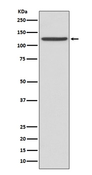 CD41 ITGA2B Rabbit Monoclonal Antibody